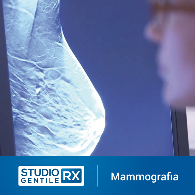 mammografiae_tomosintensi_digitale_a_Bagheria_Palermo.png